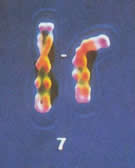 Cromosoma 7