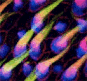 Imagen de células ciliadas del oído interno
